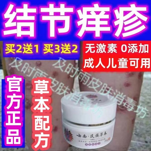 结节性痒疹纯中药膏已治好上万人