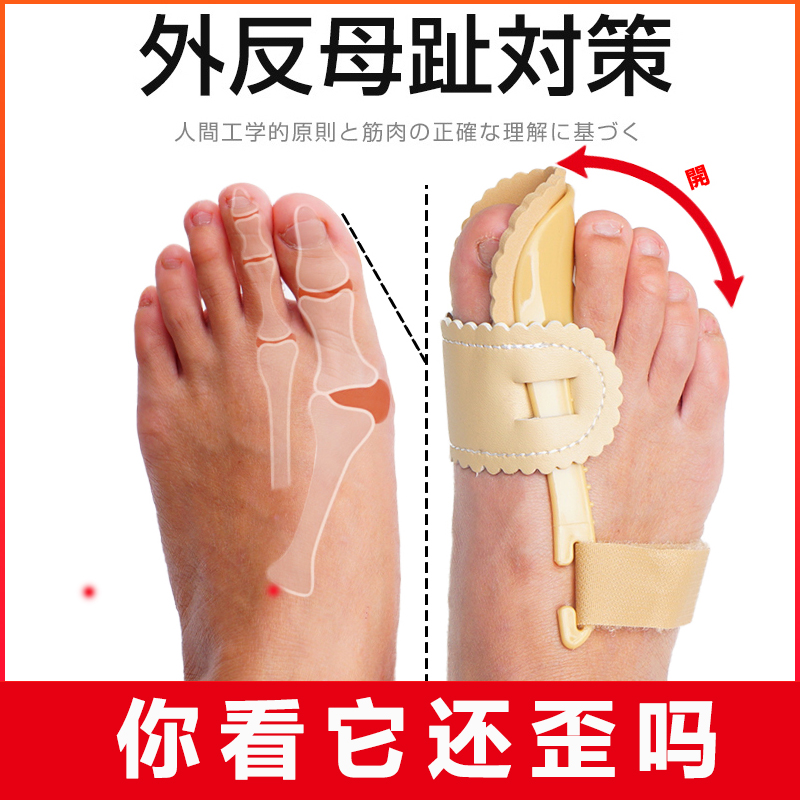 大脚骨突出矫正器拇外翻脚大拇指外翻脚拐变形母趾改善矫正分趾器