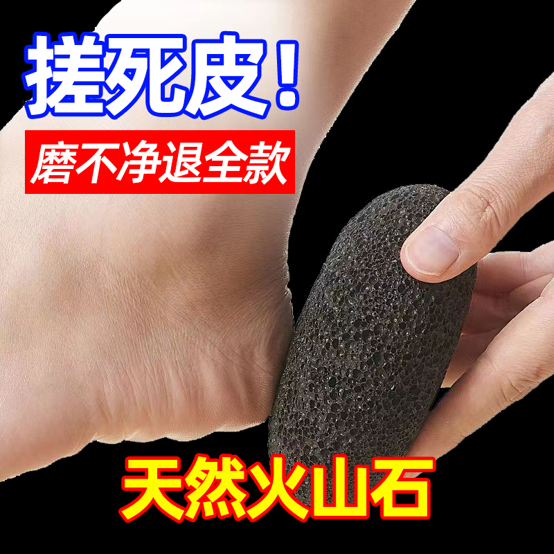 修脚神器去死皮老茧家用脚后跟刮脚底磨脚石刀挫脚皮打磨器搓脚板