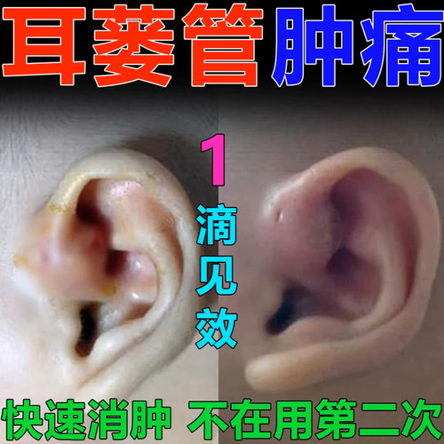 硼酸滴耳液买送维真园酒精抑菌液外用清理耳道官方正品GW