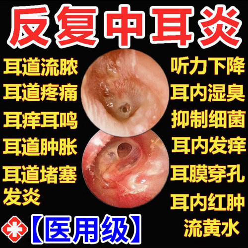 水杨酸酒精抑菌液维真园液滴耳液成人用耳痛清洁液官方正品GW