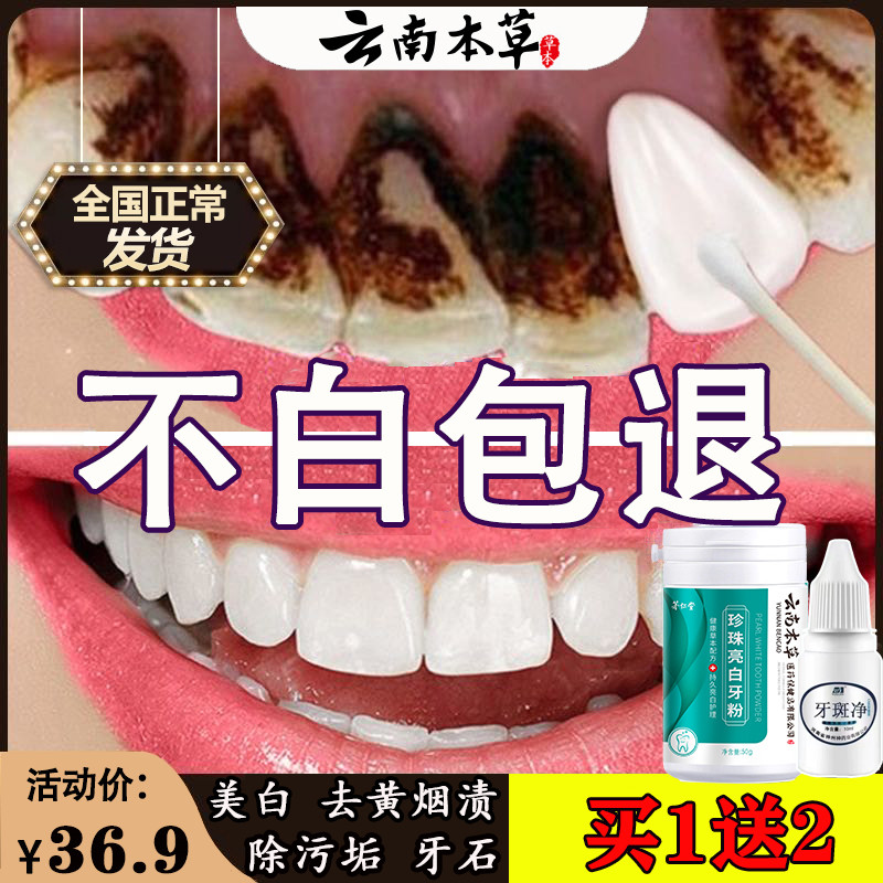 牙粉去黄洗白美白神器速效黄牙去口臭牙垢黄渍清洁牙齿污垢除牙石
