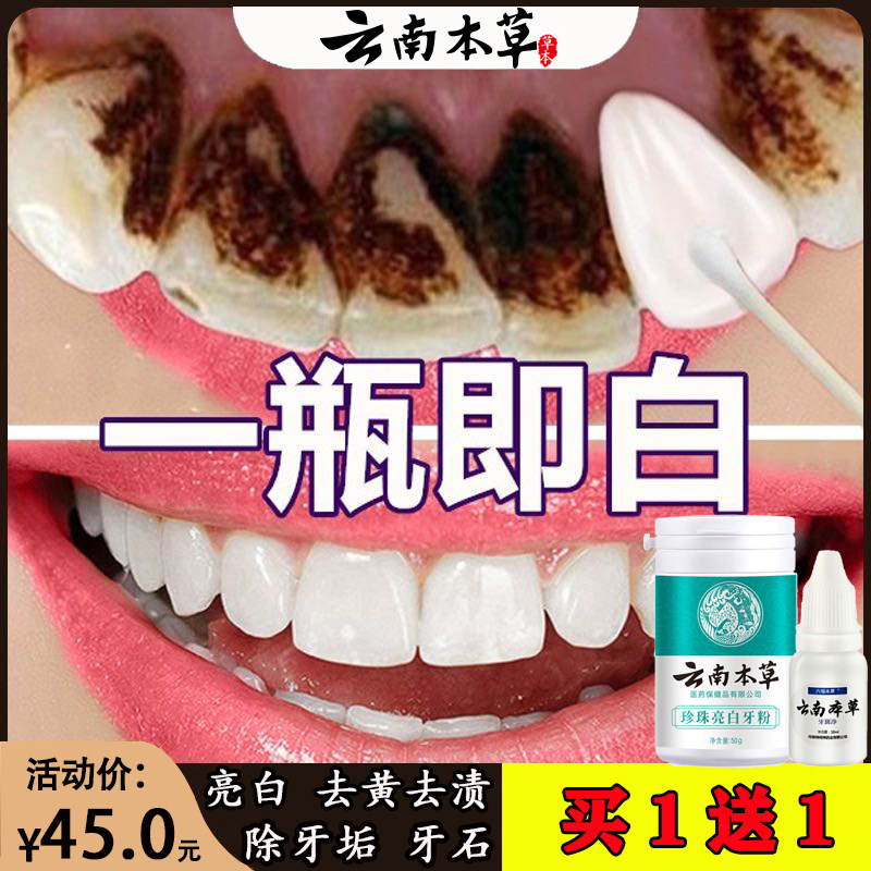 洗牙粉去黄牙黄洗白美白神器速效烟渍除牙石洁牙齿污垢牙结石亮白