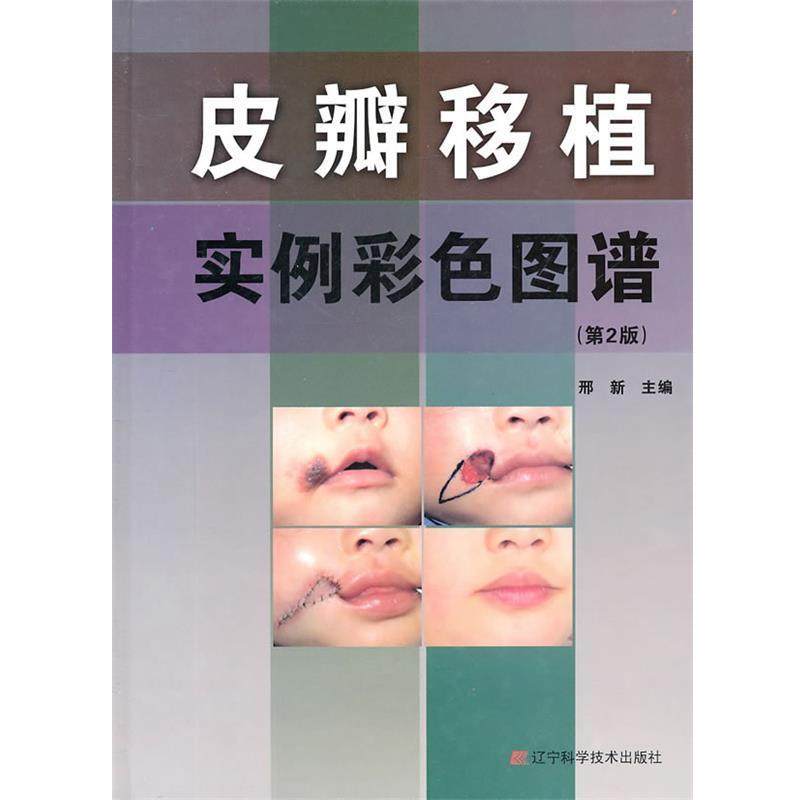 【正版】皮瓣移植实例彩色图谱（第2版）【单本】 邢新