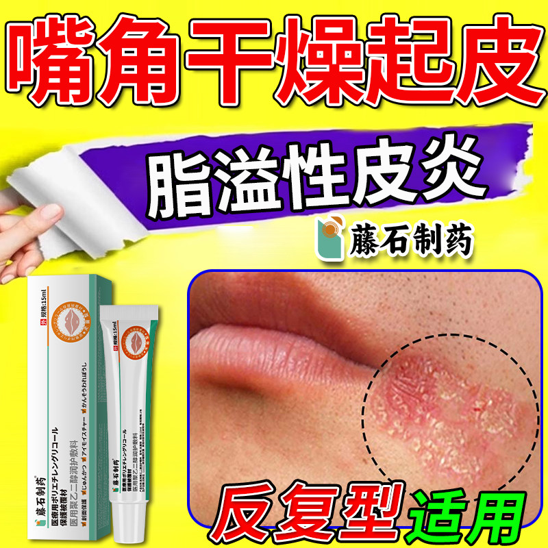 嘴角干燥起皮长癣下巴脸上脂溢性皮炎面部嘴周围藓红痒药监备案SE