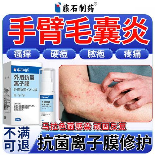 【医用抗菌离子膜】手臂毛囊炎