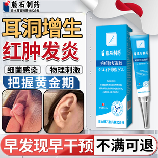 耳洞增生疤痕疙瘩凸起硬肉软化针可搭膏药贴止软化痒乳膏去SE