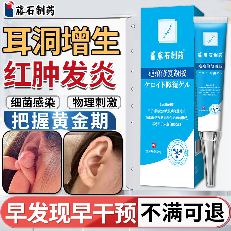 耳洞增生疤痕疙瘩凸起硬肉软化针可搭膏药贴止软化痒乳膏去SE