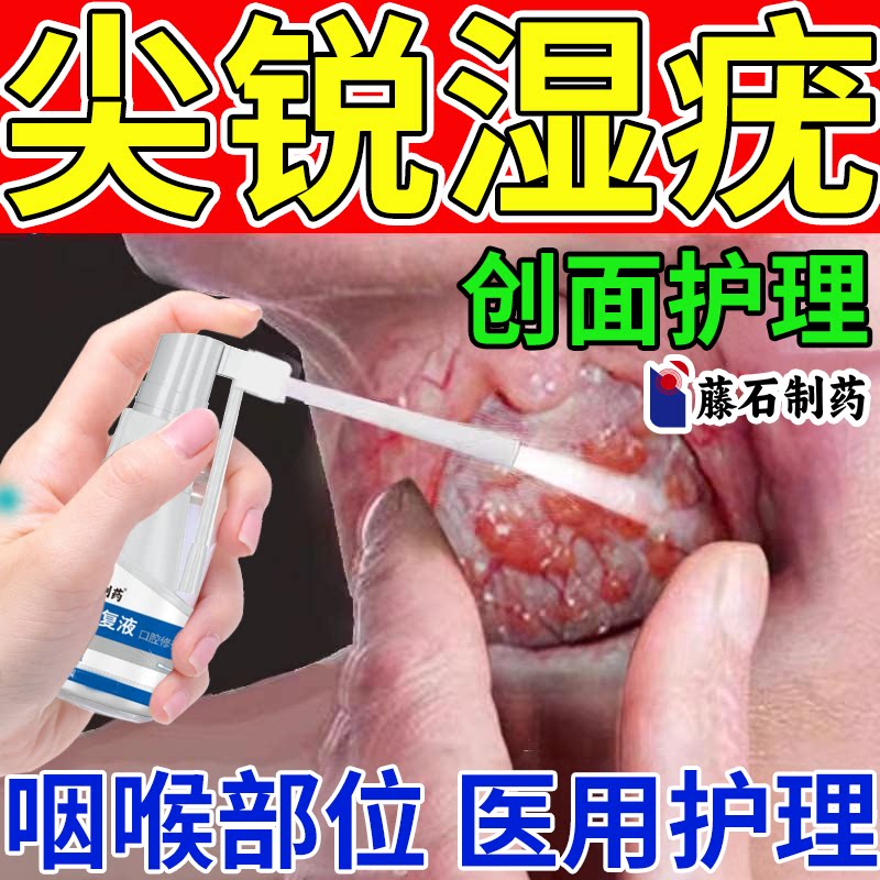 咽喉可搭口腔尖锐湿疣创面专药监备案用男喷剂检自测去非抗病毒CS