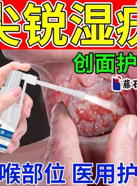 咽喉可搭口腔尖锐湿疣创面专药监备案用男喷剂检自测去非抗病毒CS