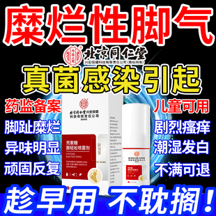 糜烂性型脚气烂脚丫药监备案脱皮糜烂脚趾缝脚痒真菌感染引起去SE