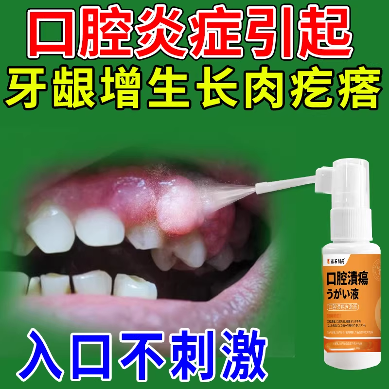 口腔炎症可搭牙龈增生息肉喷剂出血脓包鼓包肿痛非牙膏肥大消的CS