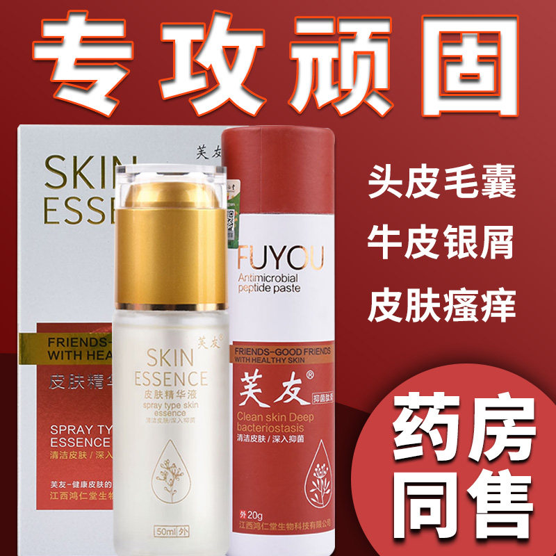 头皮毛囊中药洗发水专用头部头痒止痒膏皮肤湿痒干燥瘙痒抑菌软膏