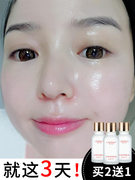 Lemino rose repair net face plant essential oil to lighten moles to improve facial moisturizing and brightening essence for men and women