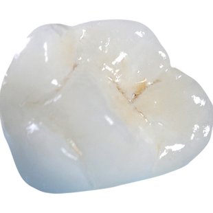 戴立克全瓷牙二氧化锆烤瓷牙定做假牙齿贝美牙冠套全瓷假牙贴片