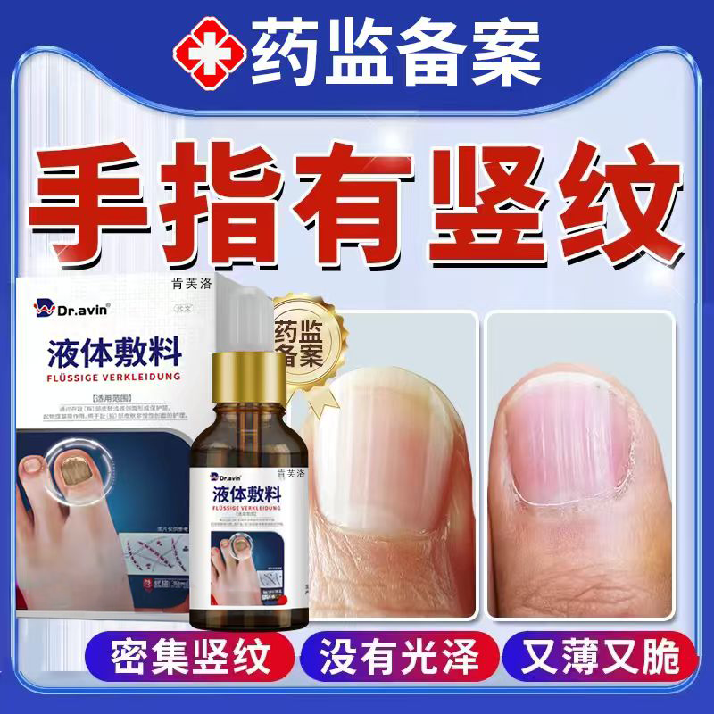 指甲有竖纹吃什么空甲受损再生分离手脚凹凸不平液药房同款膏YY