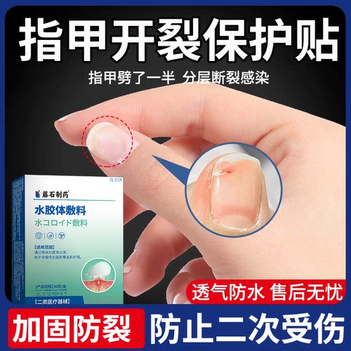 【速发】指甲开裂劈了加固保护贴