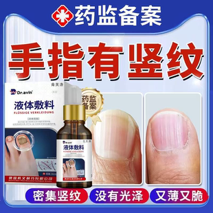 指甲有竖纹吃什么空甲受损再生分离手脚凹凸不平液药房同款膏YY