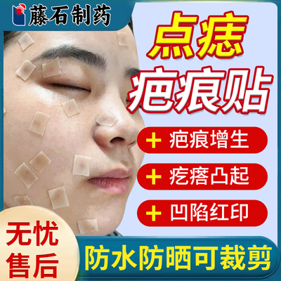 点痣疤痕贴防水防晒预防淡化疤痕