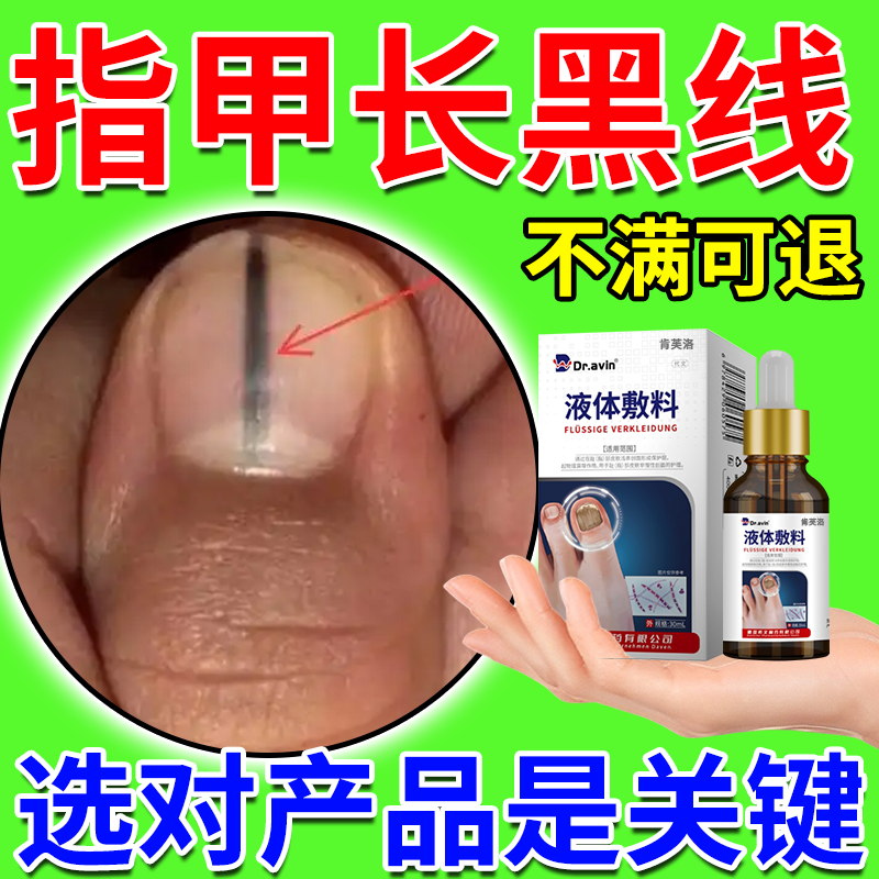 【德国公司监制】指甲长黑线