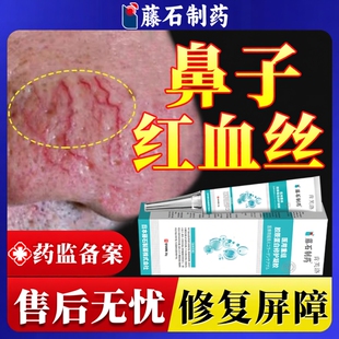玫瑰痤疮酒糟鼻专用修复膏酒渣鼻子红血丝男士去除鼻头药房同款YY