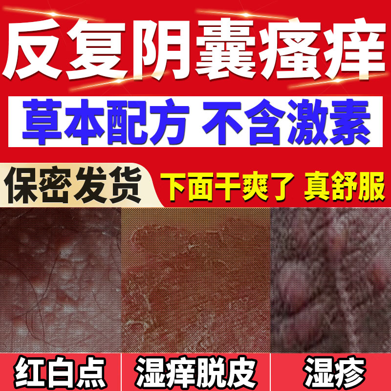 男士私处止痒抑菌药房同售膏睾丸潮湿阴囊杀菌瘙痒特洗液效消炎RO