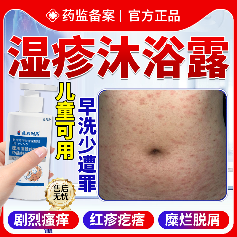 湿疹沐浴露热毒止痒膏泡澡包香皂专用皮疹洗液脖子热疹去皮肤根YS