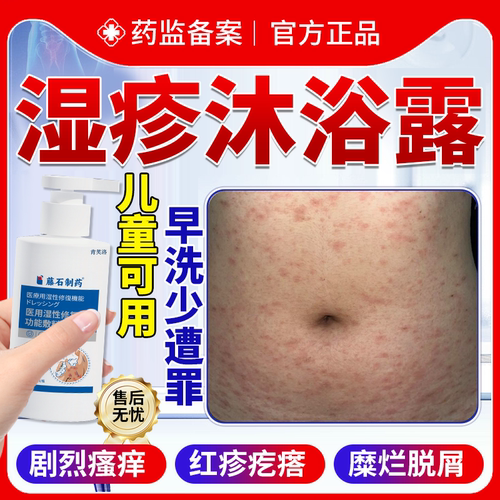 【速发】湿疹皮肤疙瘩瘙痒沐浴露