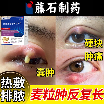 日本公司监制】麦粒肿蒸汽眼罩