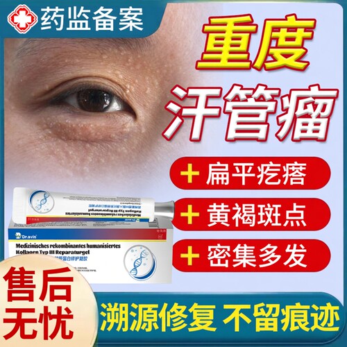 【速发】汗管瘤眼周小颗粒凝胶