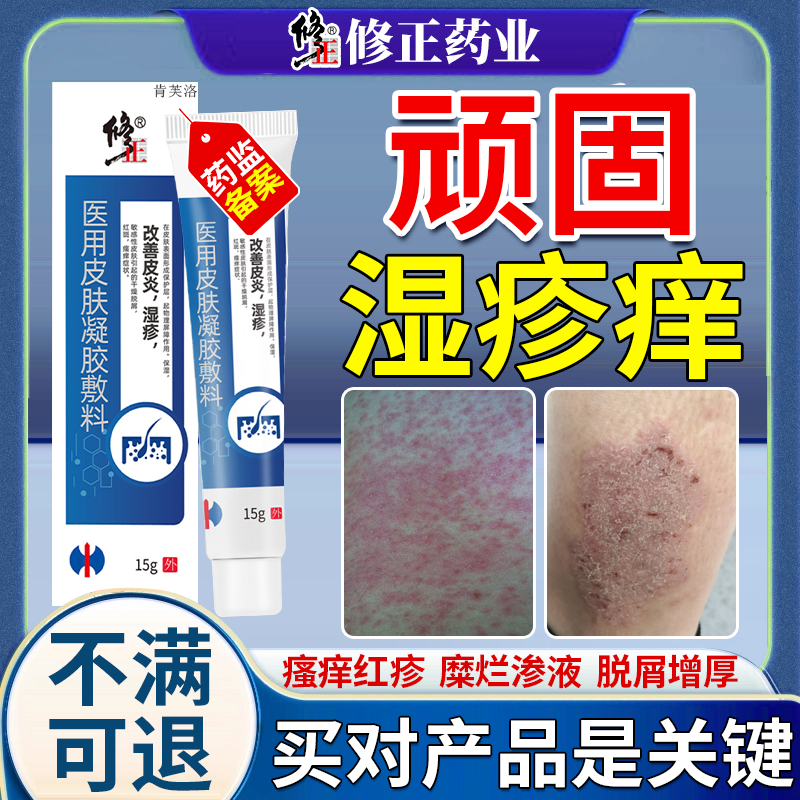 【速发】顽固湿疹瘙痒红斑膏
