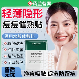 红肿硬块痘痘催熟弘生痘痘贴祛石头痘修复消炎痘印医用型吸脓级YS