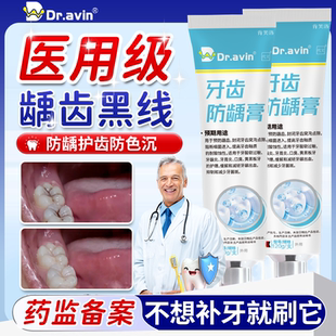 牙齿非牙膏防蛀牙龋齿修复去黑线去除黑渍牙窝沟黑斑医用型含氟YS