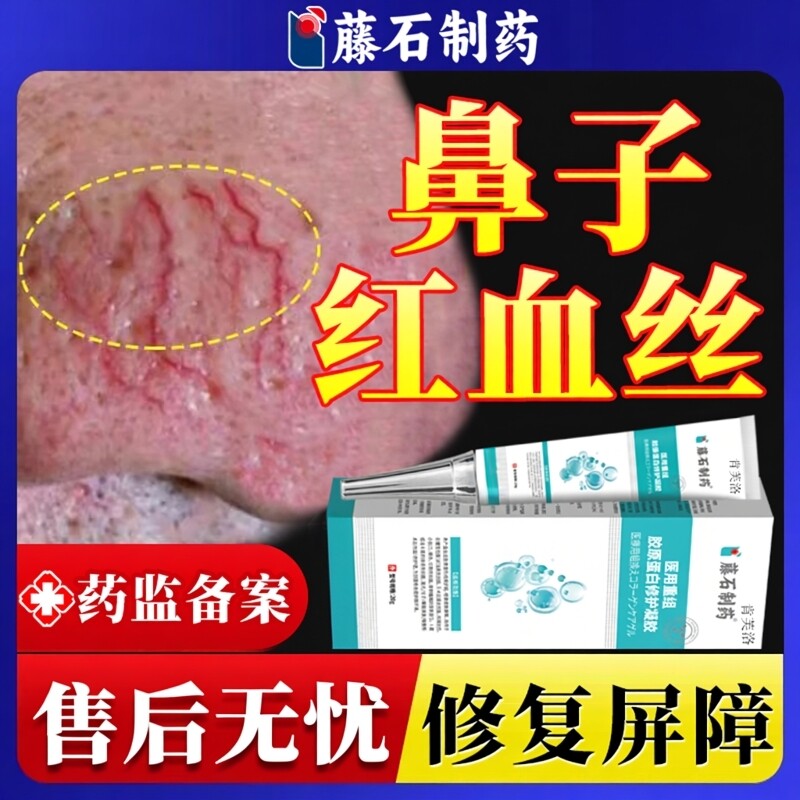玫瑰痤疮酒糟鼻专用修复膏酒渣鼻子红血丝男士去除鼻头药房同款YY