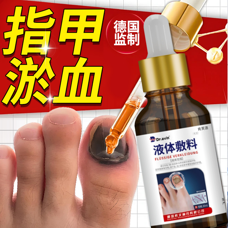 指甲淤血受损Dr.avin修复液