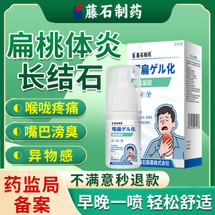 扁桃体炎长结石喷剂贴喉咙肿痛专用凝胶口臭异物感吞咽困难疼痛YS