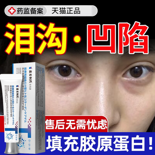 速发】泪沟凹陷胶原蛋白填充因子