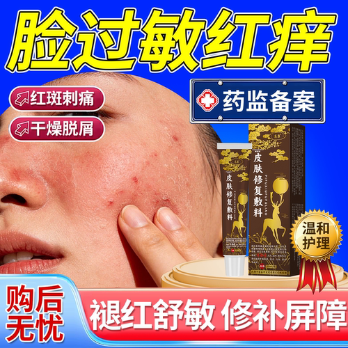 【速发】脸上过敏红痒屏障修护膏