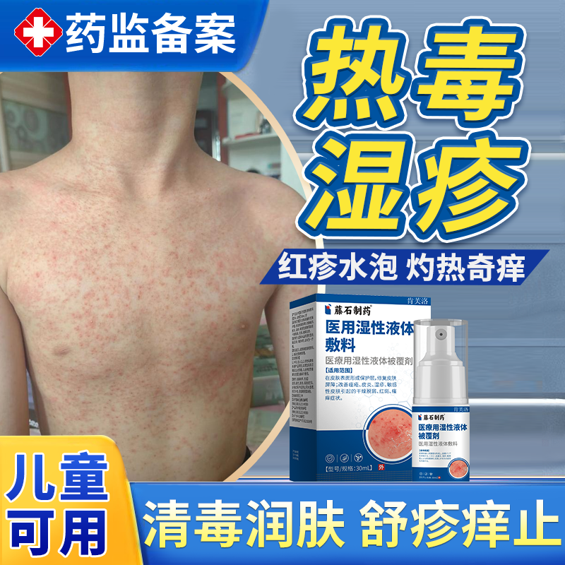 热毒湿疹止痒膏皮肤一热就痒去湿毒根血热非湿毒清软膏药膏热疹YS
