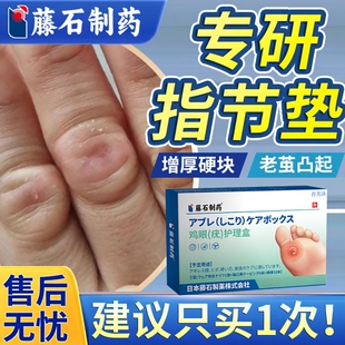 手指关节茧指节垫药房膏手上长硬疙瘩老茧去除去茧子根软化专用YS