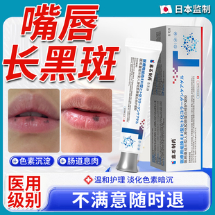 嘴唇黑斑去除凝胶发黑淡化黑色素沉淀唇周黑点乌唇唇炎黑痣护理YM