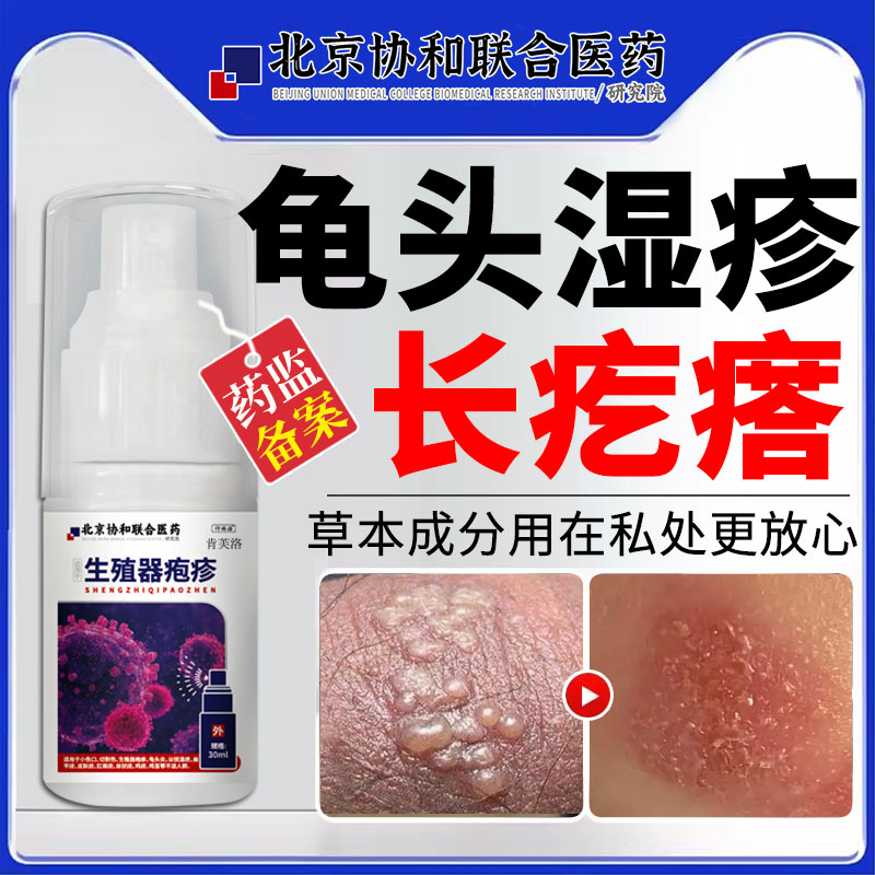 龟头湿疹长小疙瘩发痒上红斑真菌感染开裂发炎豆腐渣白垢包皮炎ro