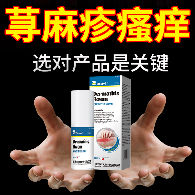 慢性寻荨麻疹过敏止痒专用非沐浴露根提高免疫力丘疹可搭膏用YS