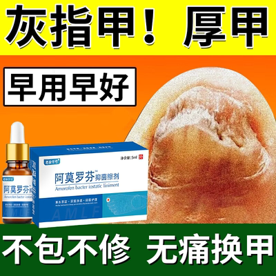 【现货速发】灰指甲厚甲增厚发黄