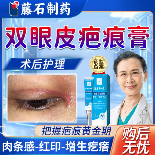 速发】双眼皮术后增生疤痕祛疤膏