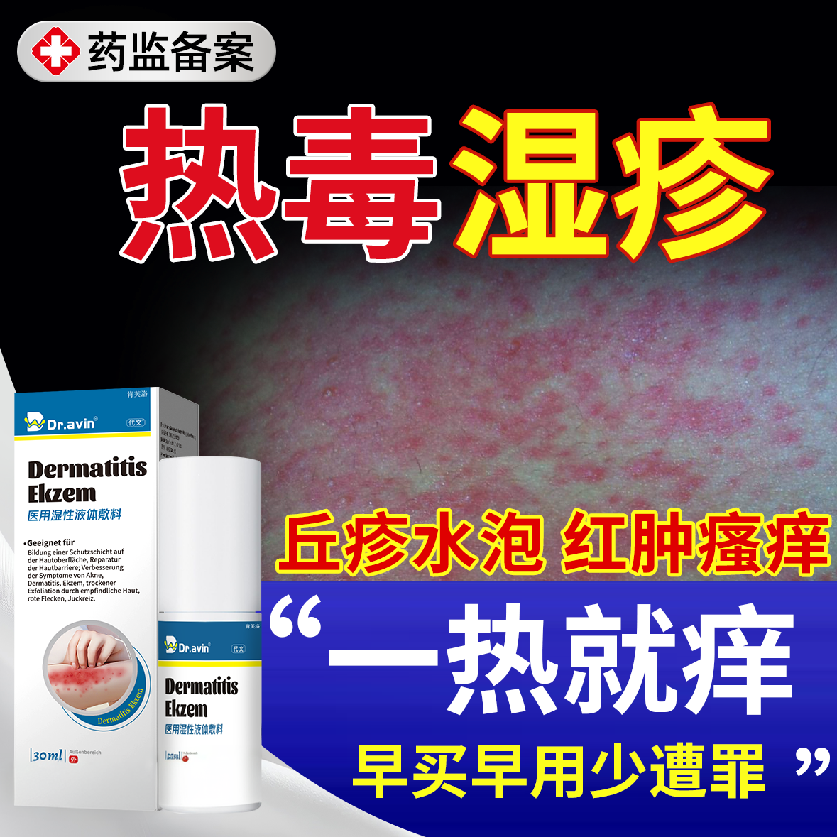 热毒湿疹止痒膏皮肤一热就痒夏天热疹成人热痱子喷雾血热皮肤痒YS