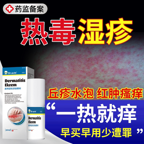 【现货速发】热毒湿疹止痒喷雾