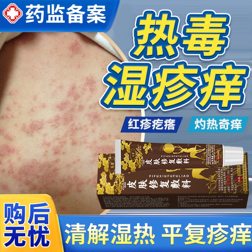 【速发】热毒湿疹皮肤修复敷料