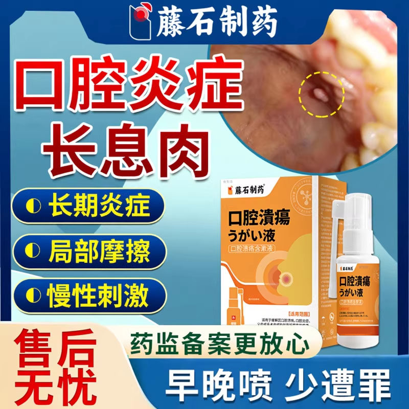 口腔炎症长息肉口腔肉芽肿肉瘤疙瘩舌下粘液腺囊肿溃疡唾液滤泡YY