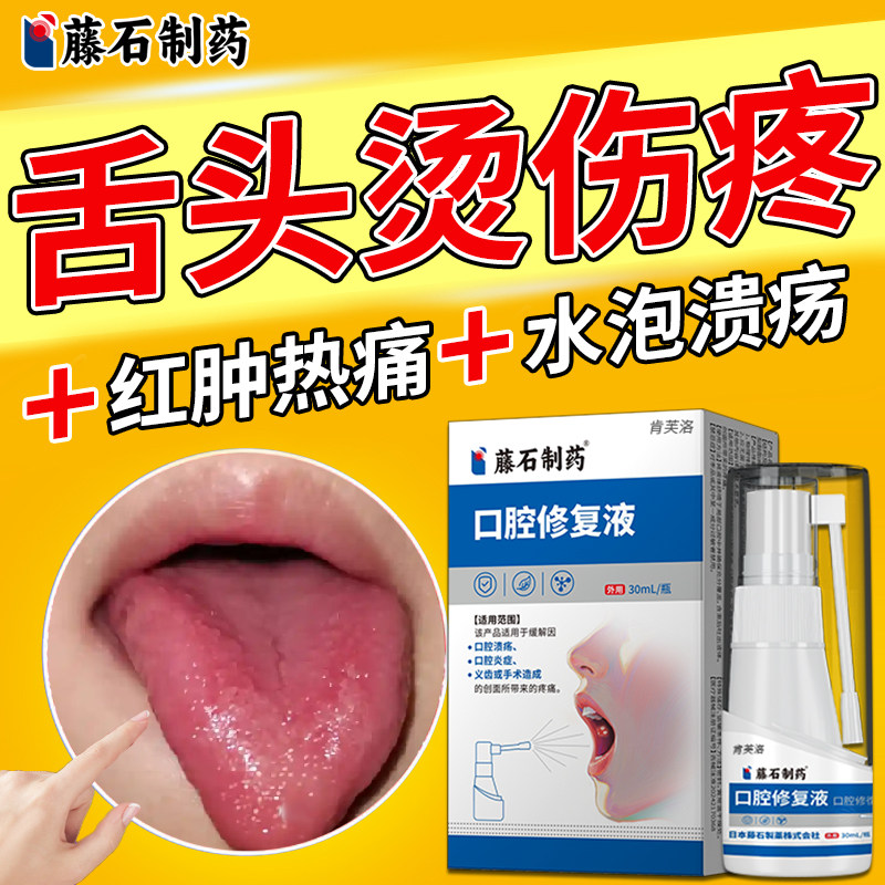 舌头烫伤喷雾红肿疼痛起泡溃疡烂口腔黏膜修复藤石制药医用喷剂YM,医疗器械,口咽类修复品,淘宝优惠券,粉丝福利购,淘宝优惠卷